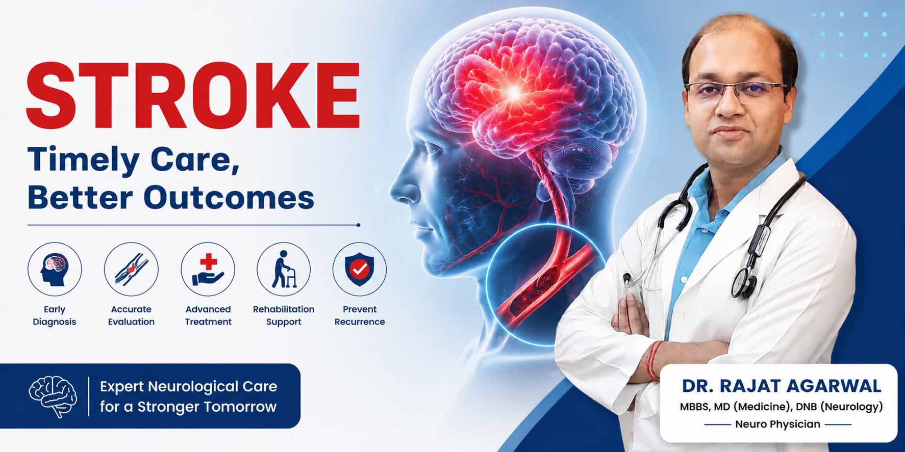 Stroke Treatment in Haldwani